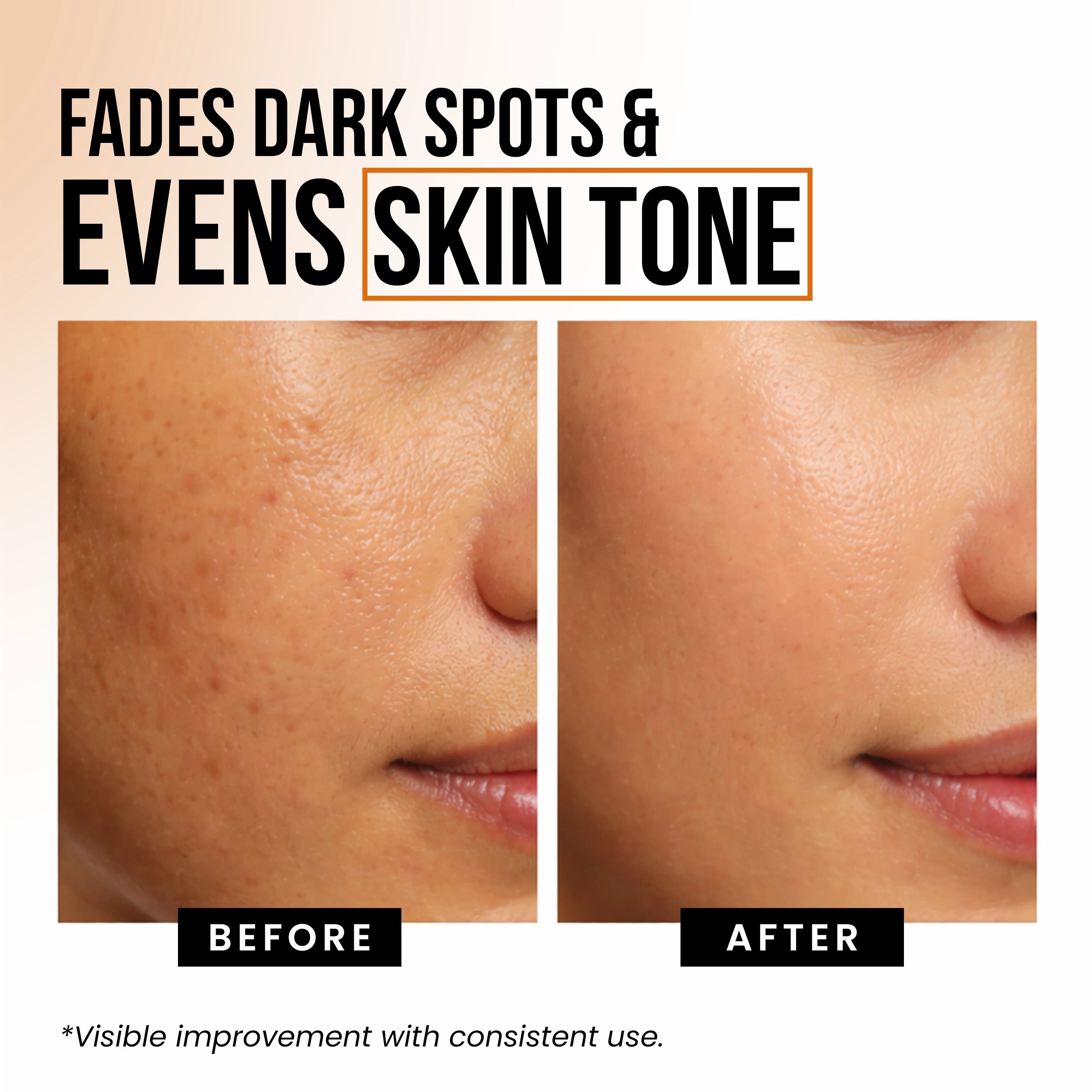 Brightening Face Serum thumbnail 3